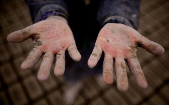 В Одесской области очередной подросток занимался недетским трудом Фото № 0 В Одесской области очередной подросток занимался недетским трудом Фото № 0