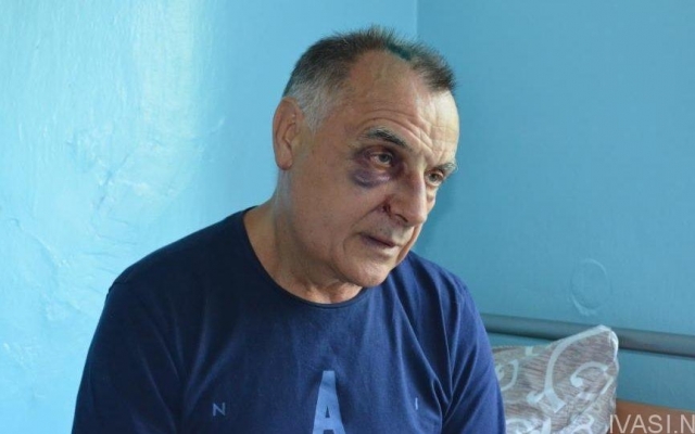 На острове Кислицкий избили депутата Одесского облсовета (ФОТО) Фото № 1 На острове Кислицкий избили депутата Одесского облсовета (ФОТО) Фото № 1