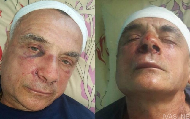 На острове Кислицкий избили депутата Одесского облсовета (ФОТО) Фото № 0 На острове Кислицкий избили депутата Одесского облсовета (ФОТО) Фото № 0