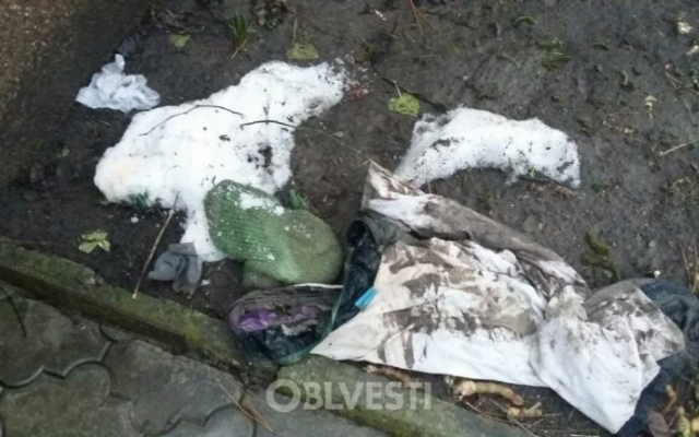 Алабаи, напавшие на пенсионерку в Санжейке, в тот день истерзали ещё одного человека (ФОТО) Фото № 0 Алабаи, напавшие на пенсионерку в Санжейке, в тот день истерзали ещё одного человека (ФОТО) Фото № 0