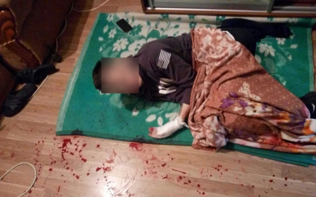 В квартиру к одесситке ворвался окровавленный вооруженный парень Фото № 1 В квартиру к одесситке ворвался окровавленный вооруженный парень Фото № 1