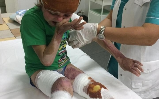 Волонтер из Одессы спасает мальчика в жутких ранениях Фото № 0 Волонтер из Одессы спасает мальчика в жутких ранениях Фото № 0