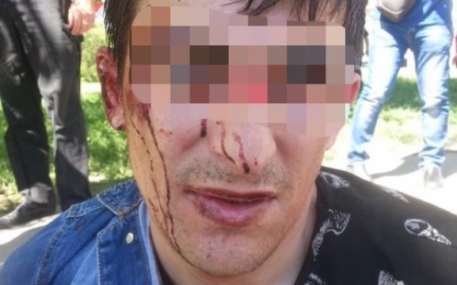 В Одессе произошло ДТП с участием бетономешалки (ФОТО, ВИДЕО) Фото № 4 В Одессе произошло ДТП с участием бетономешалки (ФОТО, ВИДЕО) Фото № 4
