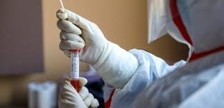 В Одесской области на сегодняшний день подозревают COVID-19 у 200 человек Фото № 0 В Одесской области на сегодняшний день подозревают COVID-19 у 200 человек Фото № 0