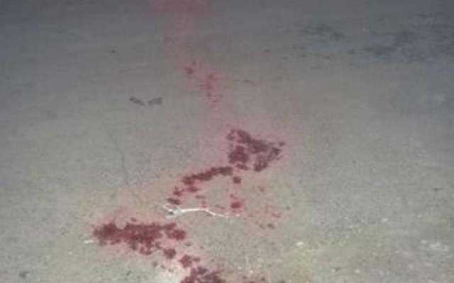 Стрельба у бара: мужчина умер по дороге в больницу Фото № 0 Стрельба у бара: мужчина умер по дороге в больницу Фото № 0