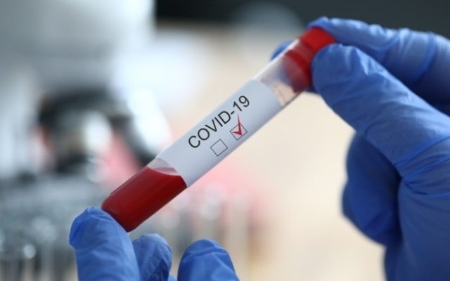 Ситуация с коронавирусом в Одесской области ухудшается Фото № 0 Ситуация с коронавирусом в Одесской области ухудшается Фото № 0