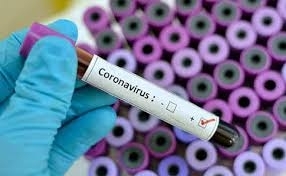 В Одесскую инфекционку завезли первые тесты на COVID-19 Фото № 0 В Одесскую инфекционку завезли первые тесты на COVID-19 Фото № 0
