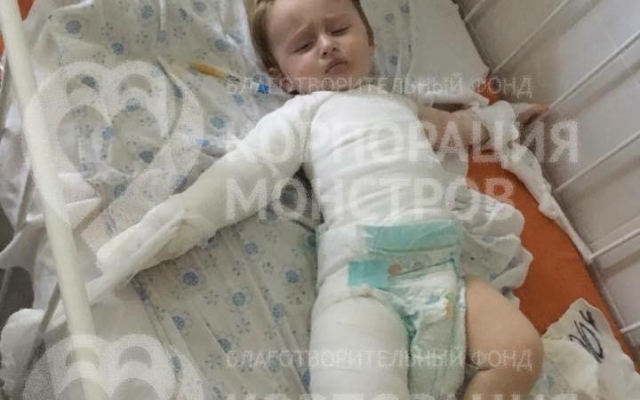 Одесская область: 9-месячного малыша ошпарило кипятком Фото № 0 Одесская область: 9-месячного малыша ошпарило кипятком Фото № 0