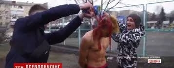 Одесский инстаблогер сняв ролик об издевательствах, сам стал жертвой буллинга Фото № 0 Одесский инстаблогер сняв ролик об издевательствах, сам стал жертвой буллинга Фото № 0