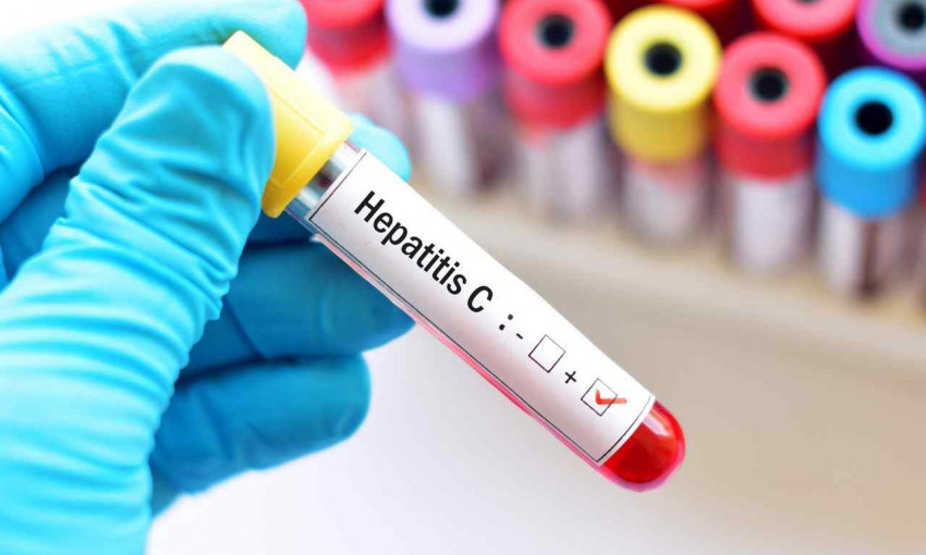 Всеукраинское тестирование на гепатит С. У Одессы — первое место по положительным результатам