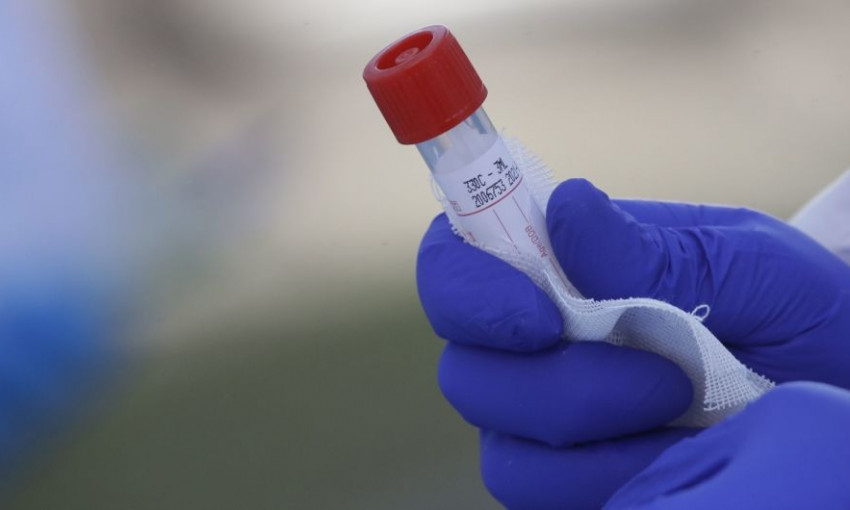 ВОЗ передала Украине ПЦР-тесты на коронавирус 