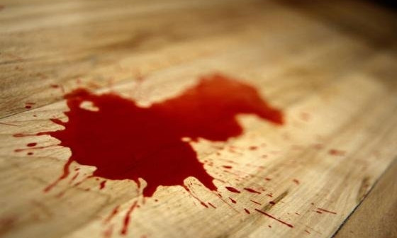 В апартаментах отеля в луже крови нашли мёртвого мужчину