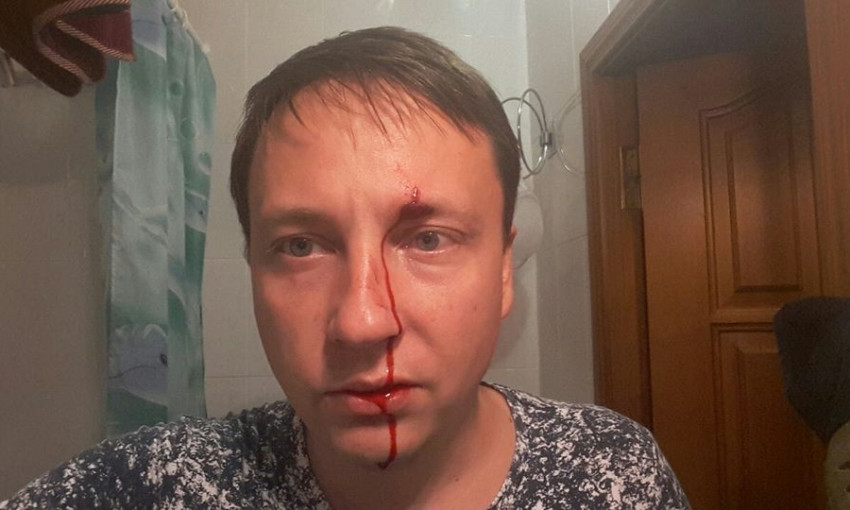 Кровавый беспредел: неизвестный напал на депутата Черноморского горсовета
