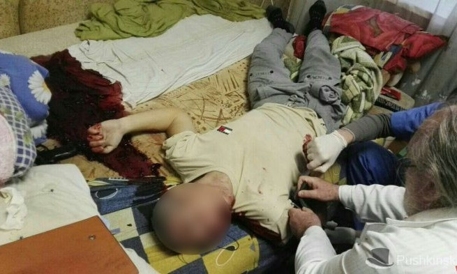 В центре Одессы мужчина выстрелил себе в голову, но остался жив