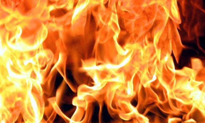 На Терешковой во время пожара обгорел одессит