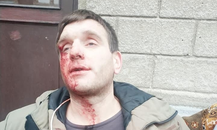 На Успенской мужчине разбили лицо и украли телефон