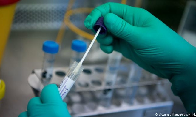 В Украине делают меньше всего тестов на коронавирус в Европе 