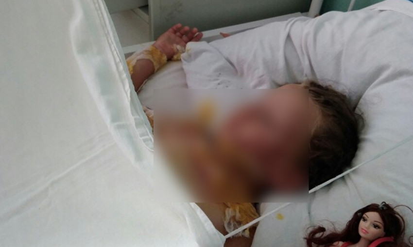 Пятилетняя одесситка умерла от ожогов - слишком поздно оказали помощь