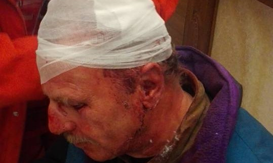 На Дерибасовской иностранец стал жертвой разбойного нападения