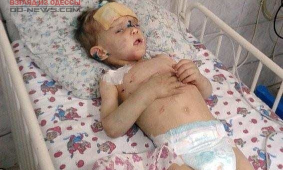 В Одессе вопиющий случай избиения ребенка