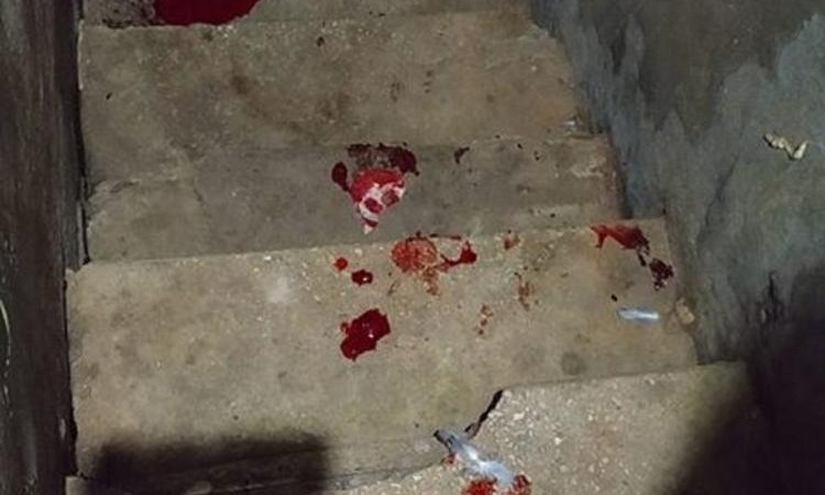Инцидент на Базарной: упавшего с разрушенной лестницы мужчину госпитализировали