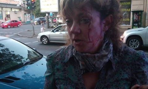 На Канатной на активисту напал неизвестный и сильно ударил  по голове