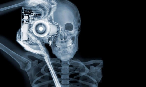 Амбулатория Одесской области обзаведётся дорогостоящим мобильным рентгеном