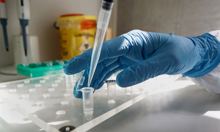 Украина начнет производство собственных тестов на коронавирус 