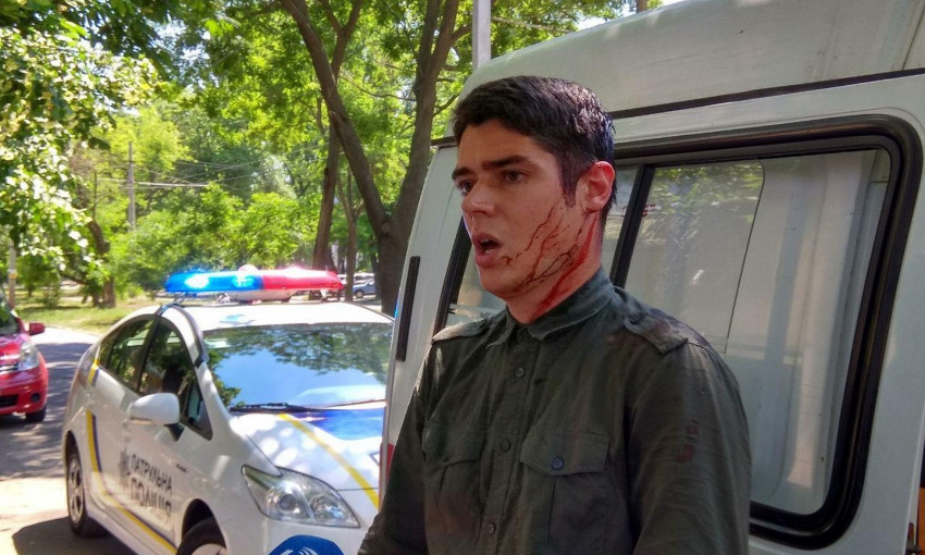 Детали нападения на лидера одесского "Автомайдана" (ФОТО, ВИДЕО)