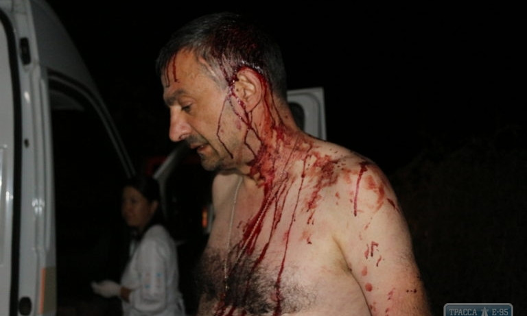 Трое мужчин с железными битами напали на журналиста