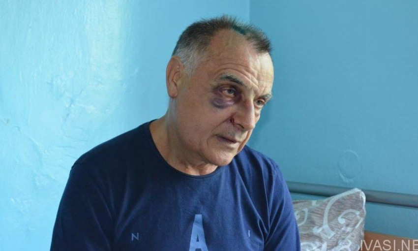 На острове Кислицкий избили депутата Одесского облсовета (ФОТО)
