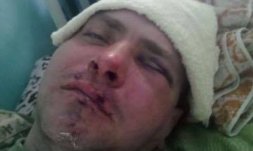 В Измаиле избили экс-бойца «Правого сектора»