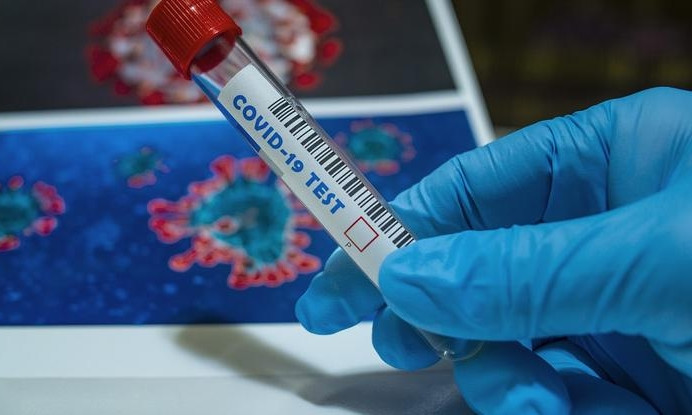 В Одесской области закончились тесты и реагенты для ПЦР-тестов на коронавирус 