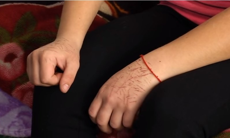 В Одесской области у школьницы обнаружили порезы на руках (ВИДЕО)